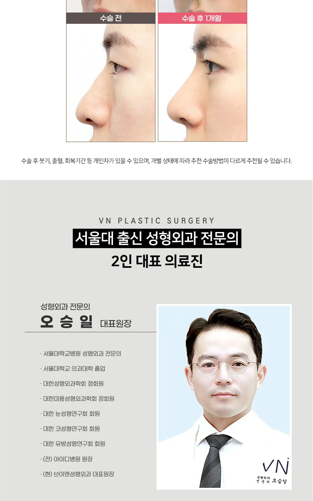 시술 상세 4