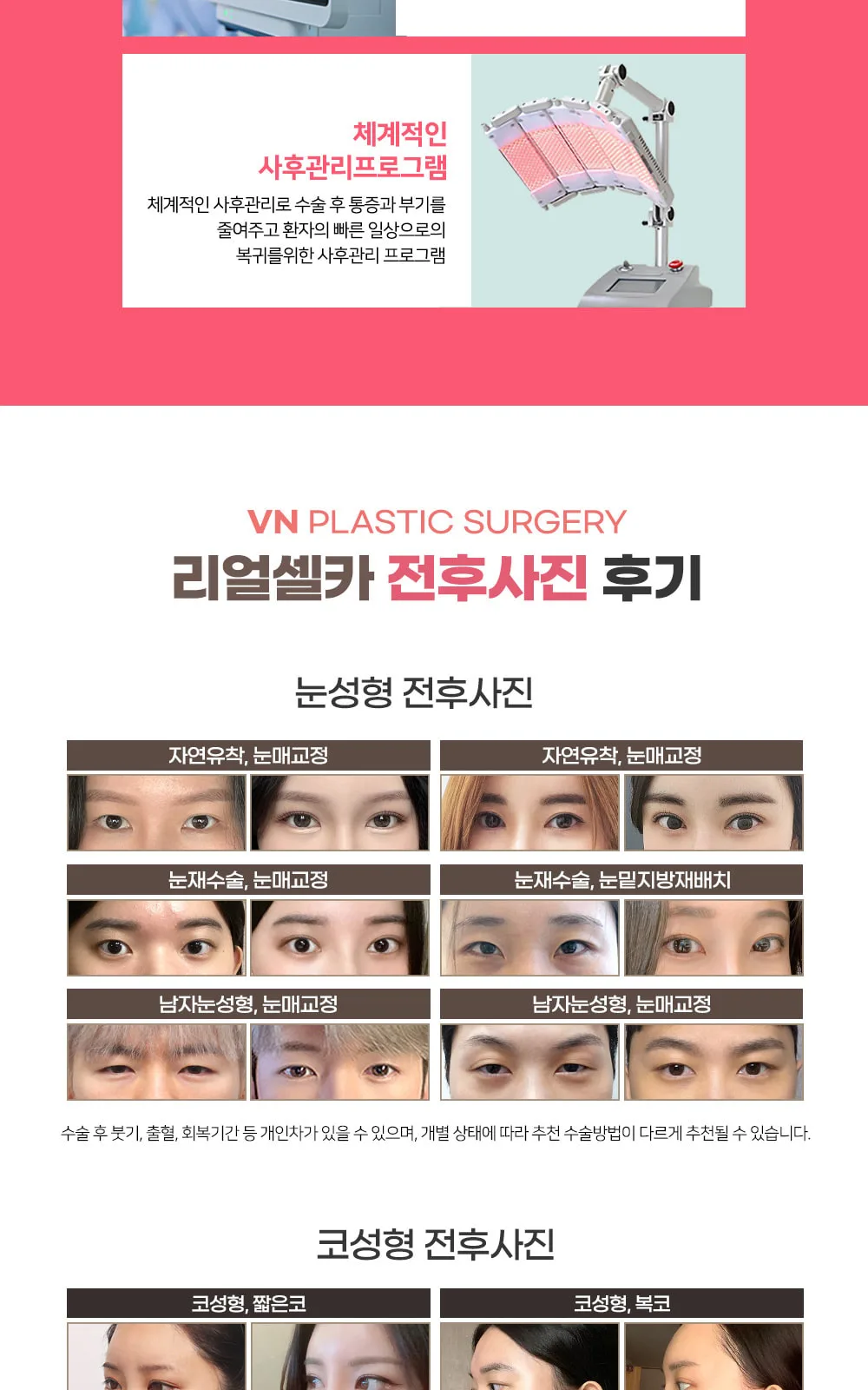 시술 상세 7