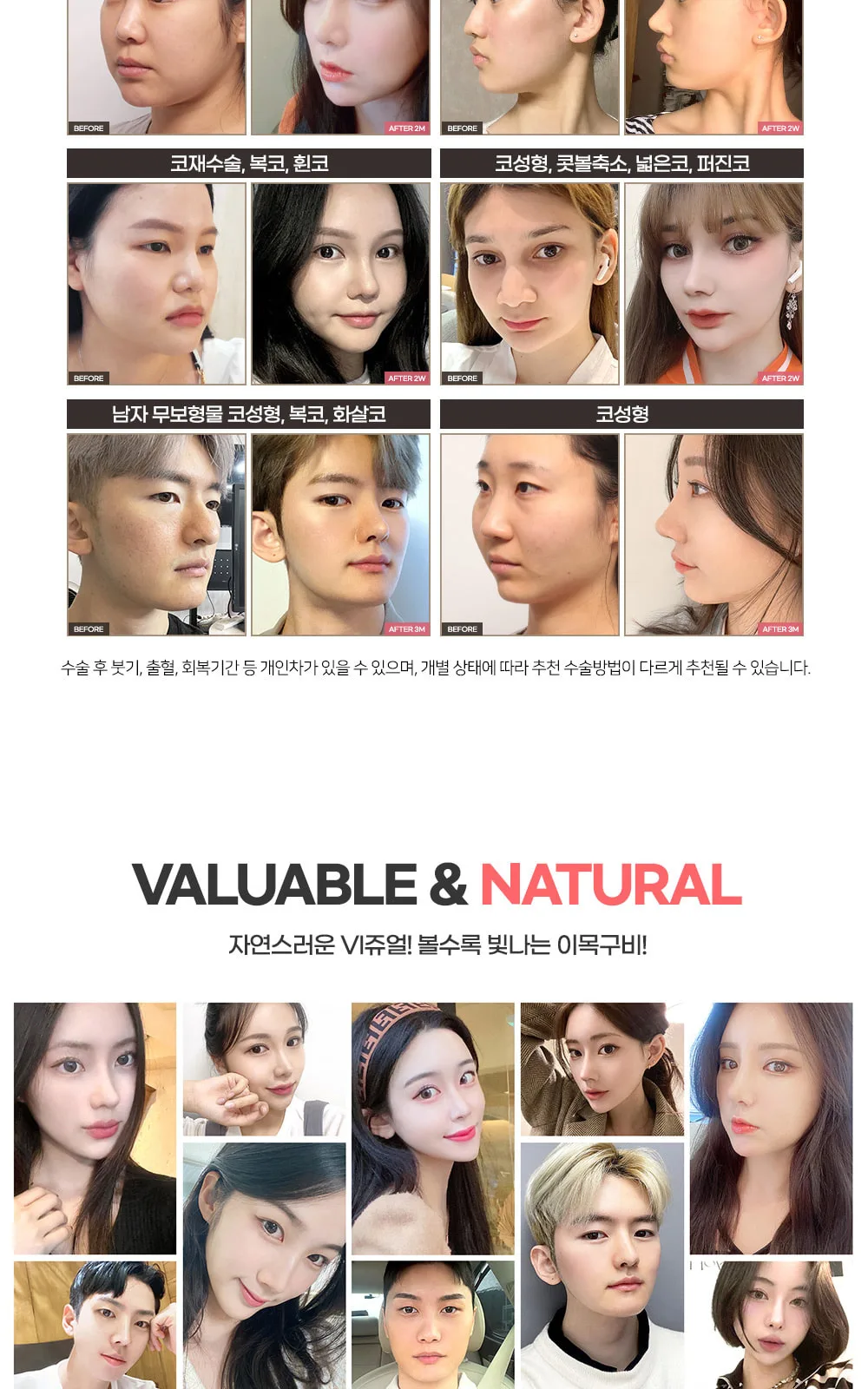 시술 상세 8