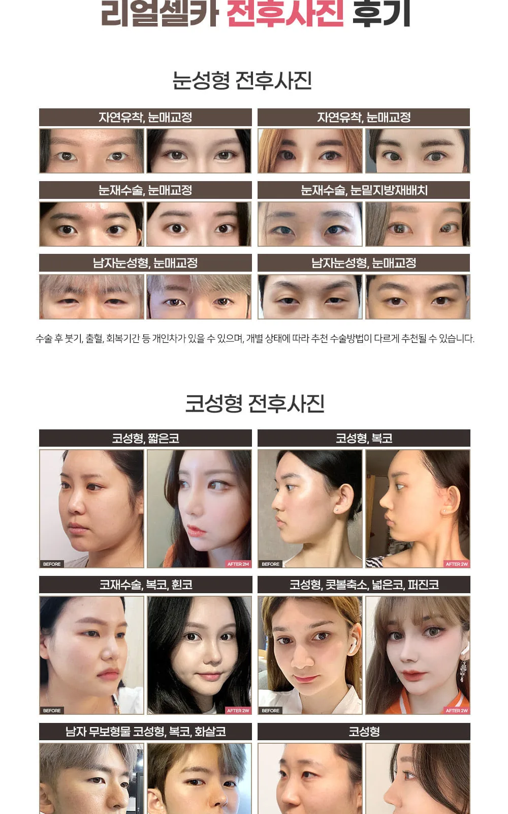 시술 상세 7