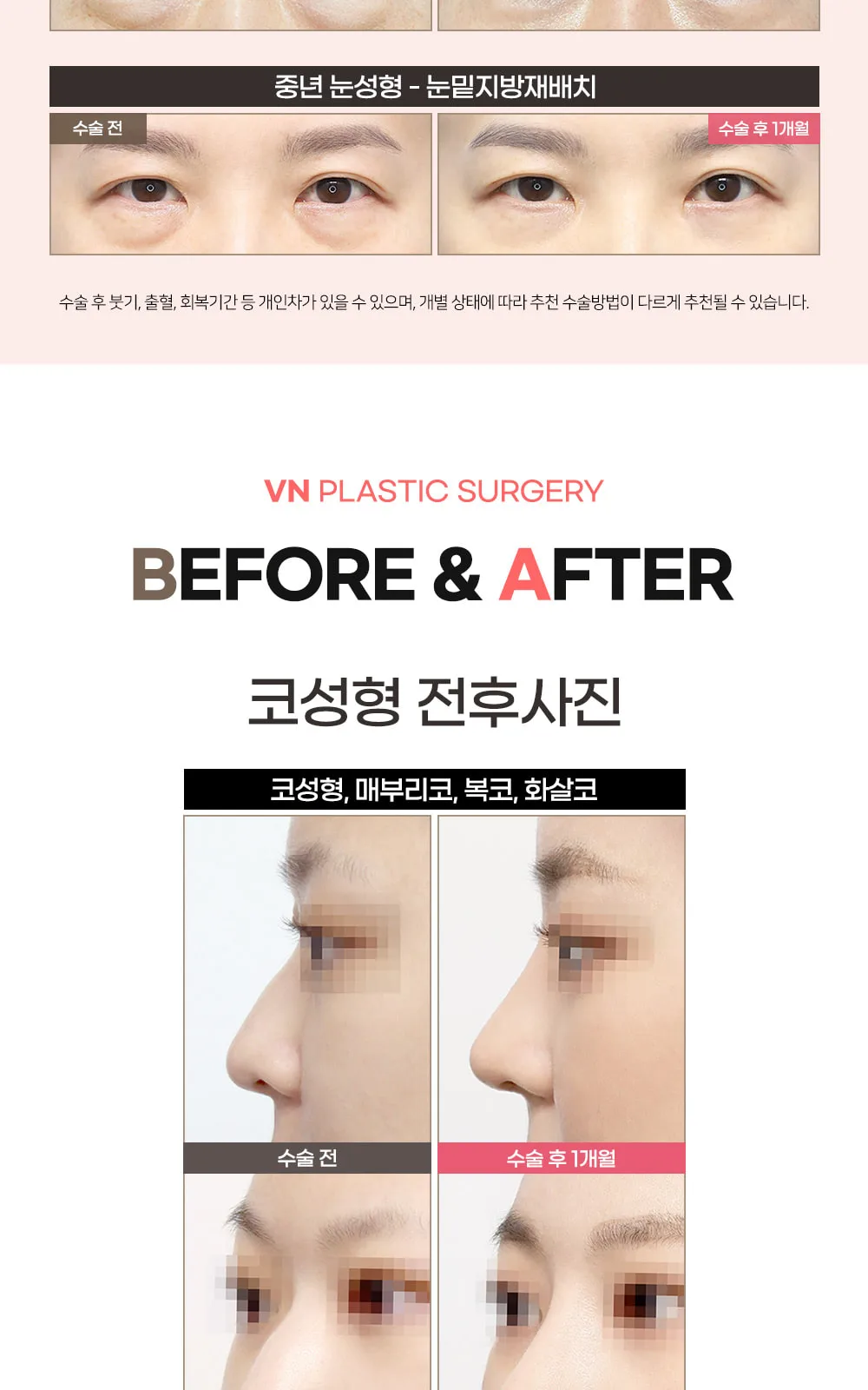 시술 상세 4