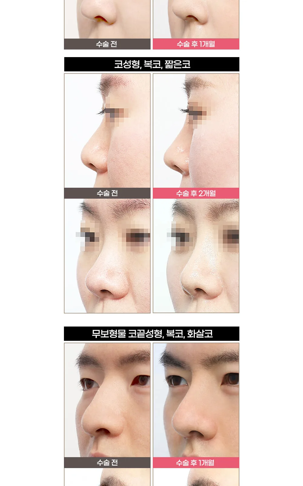 시술 상세 5