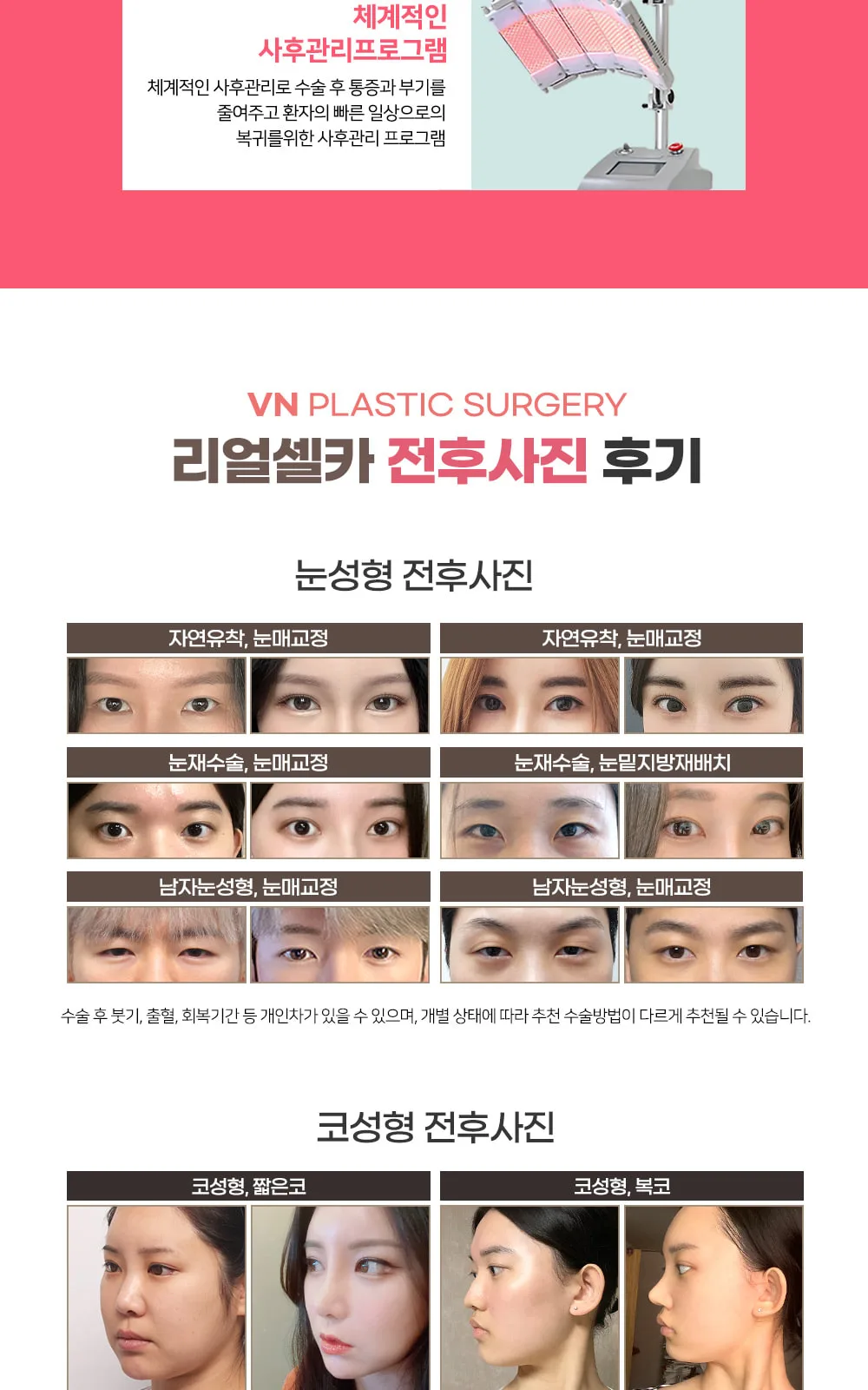시술 상세 9