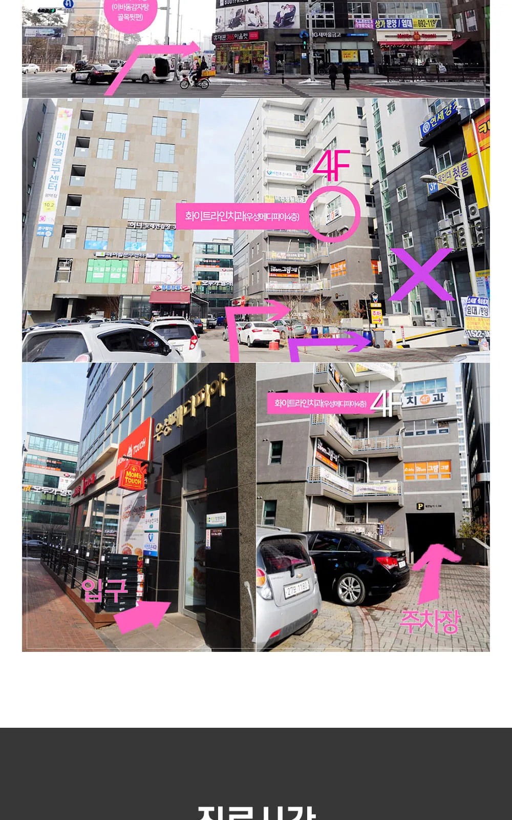 시술 상세 11
