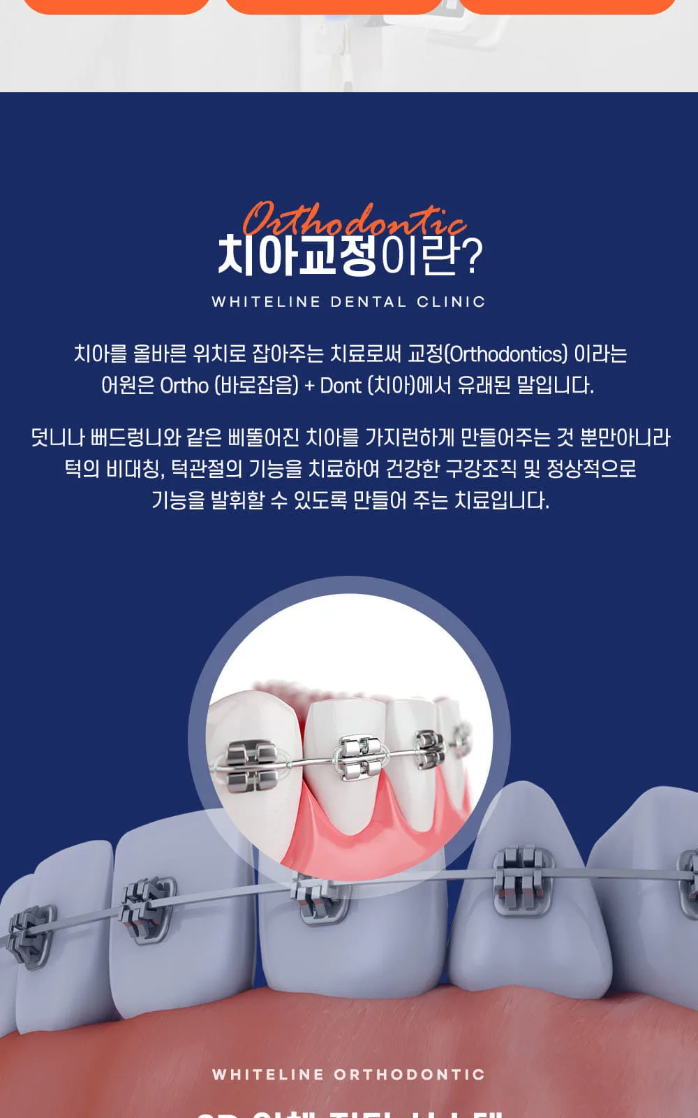 시술 상세 4