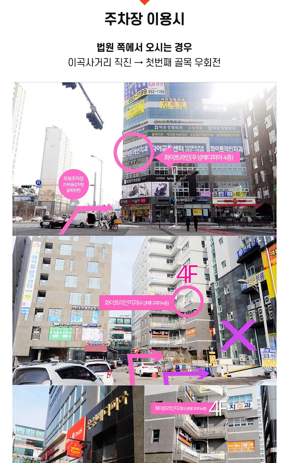 시술 상세 12