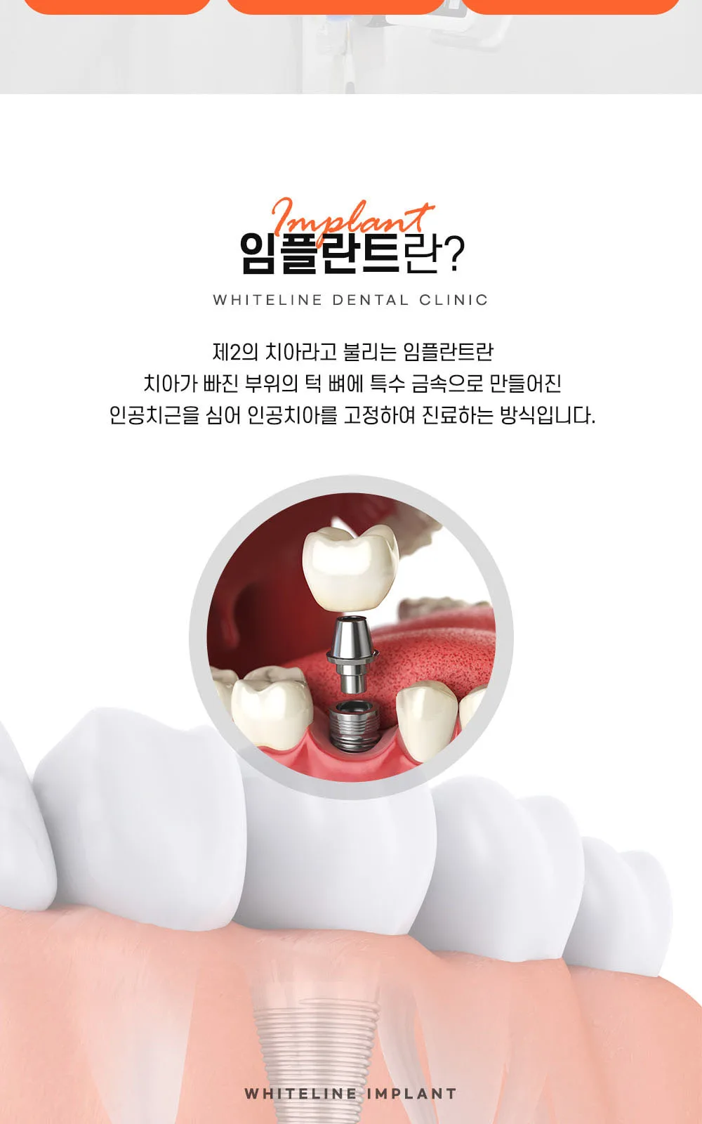 시술 상세 4