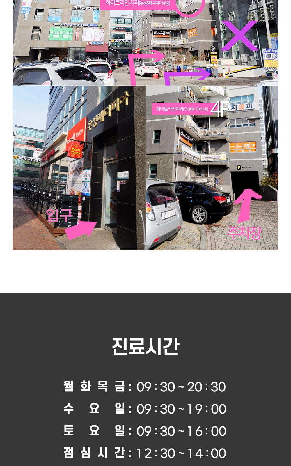 시술 상세 10