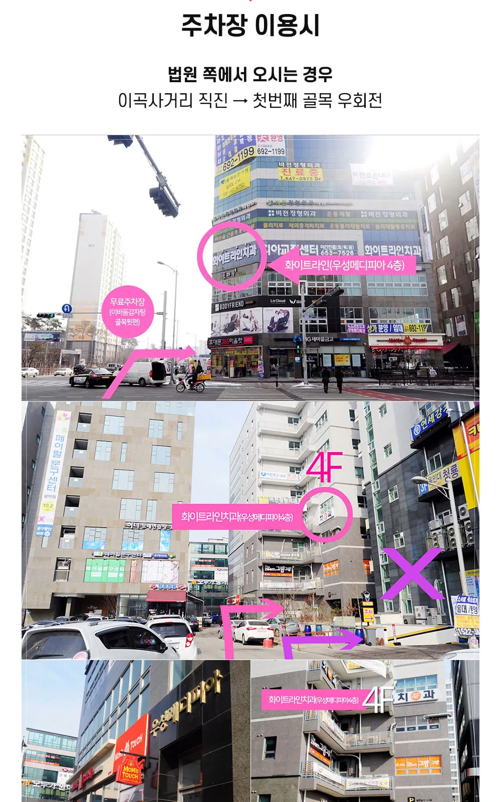 시술 상세 18
