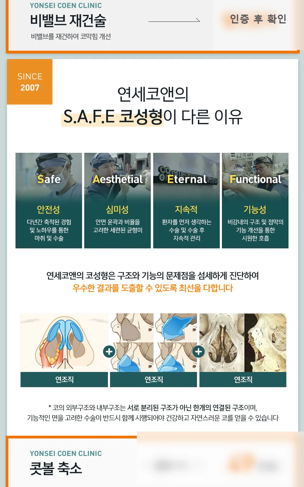 시술 상세 4
