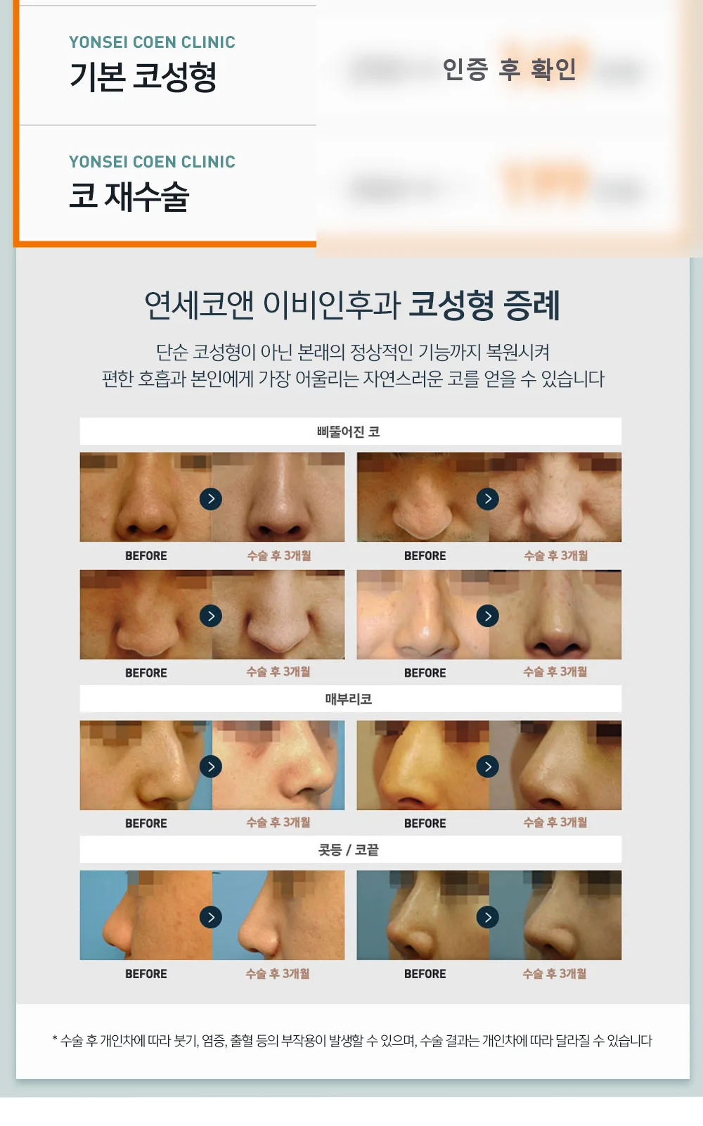 시술 상세 5