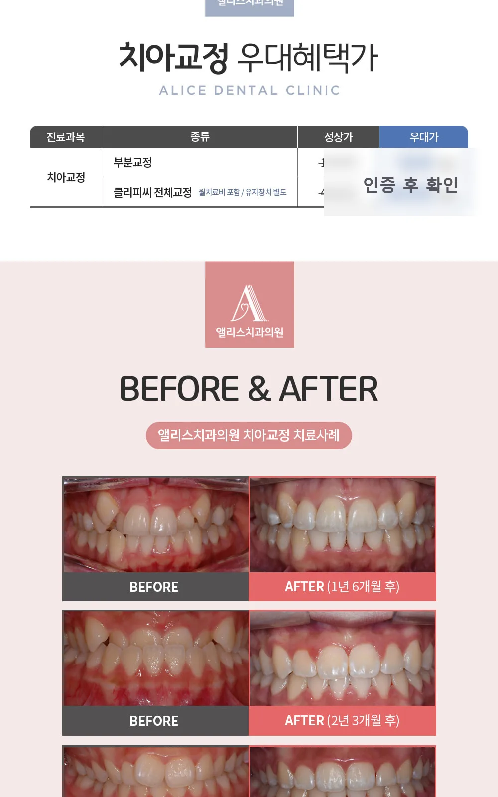 시술 상세 2
