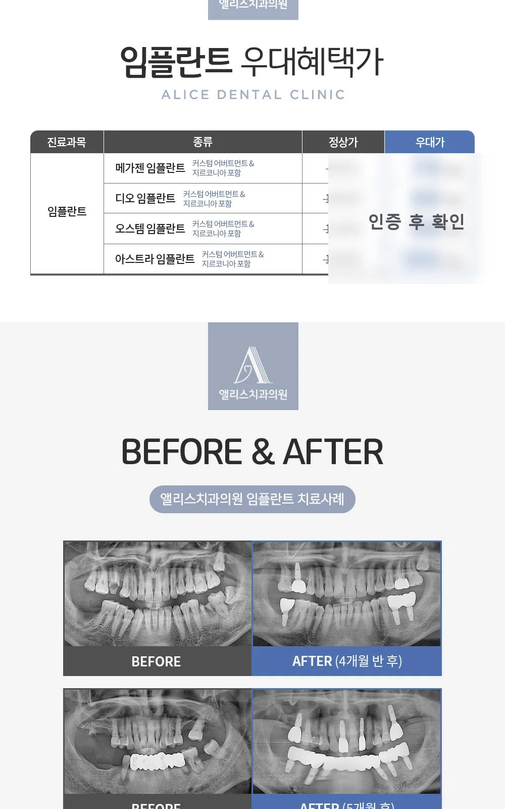 시술 상세 2