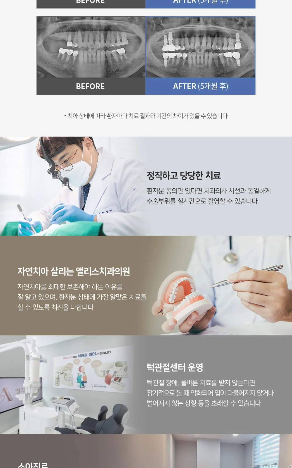 시술 상세 3