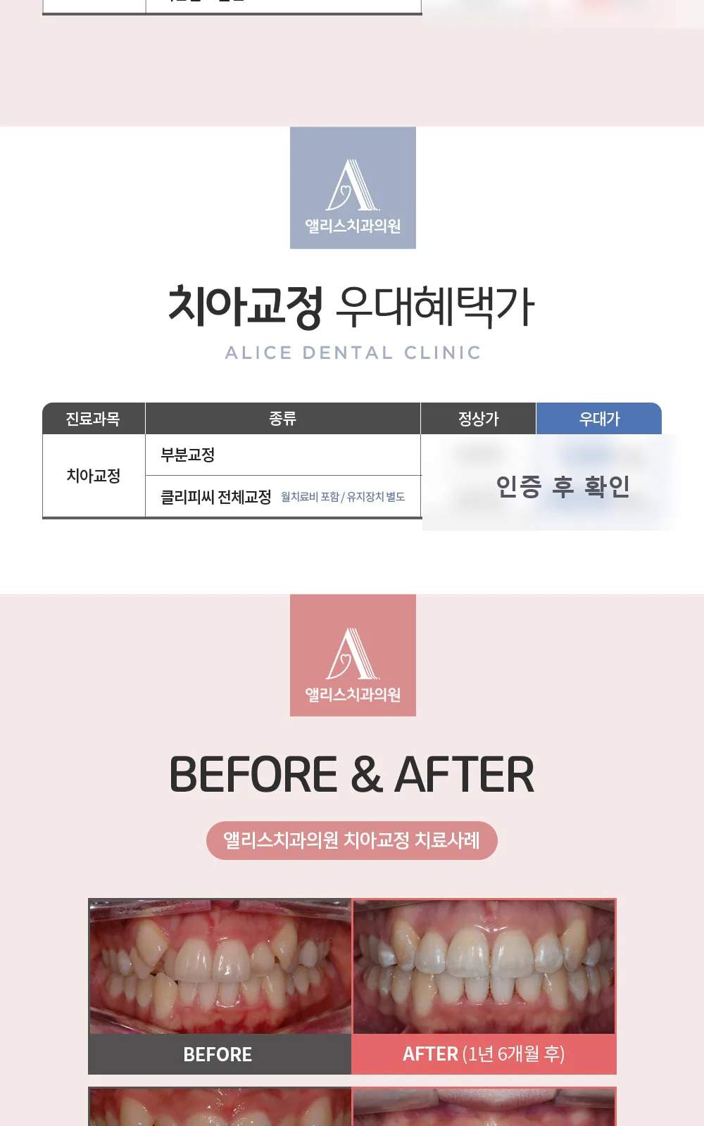 시술 상세 3