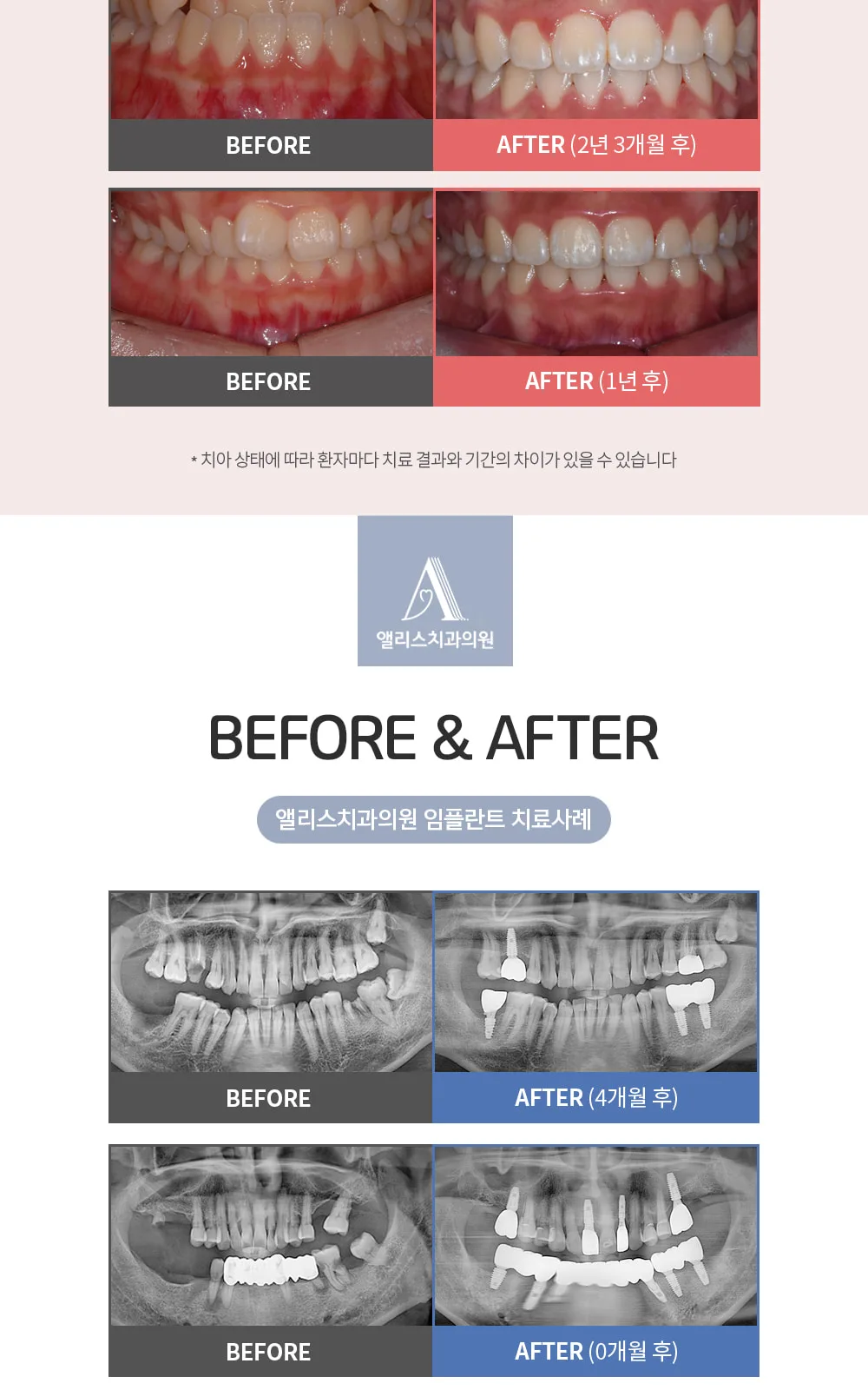시술 상세 4