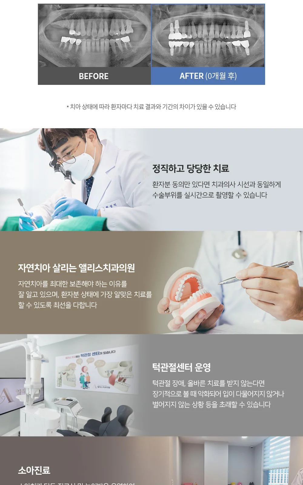 시술 상세 5