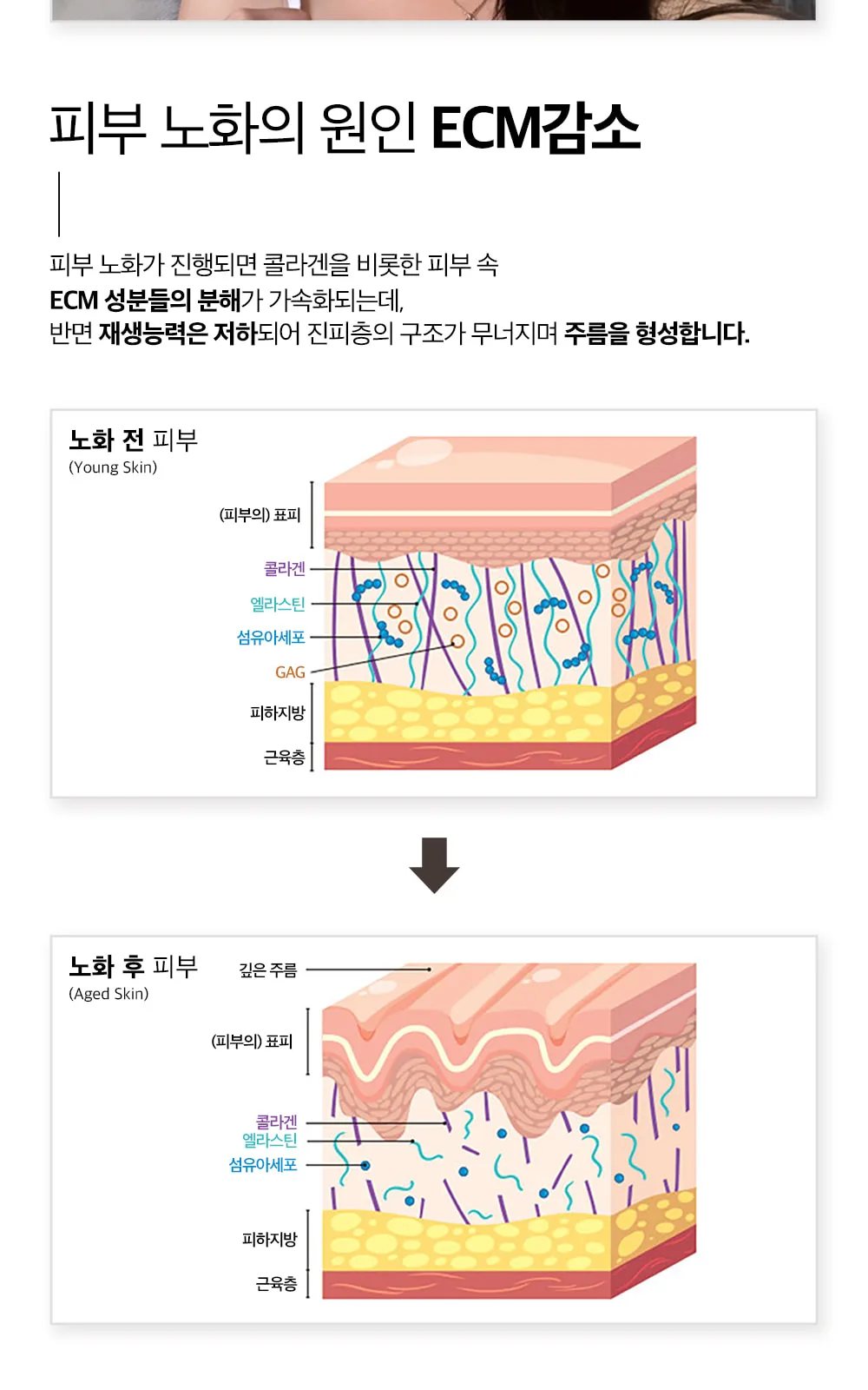 시술 상세 4