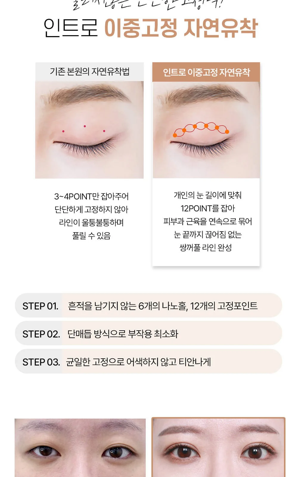 시술 상세 4
