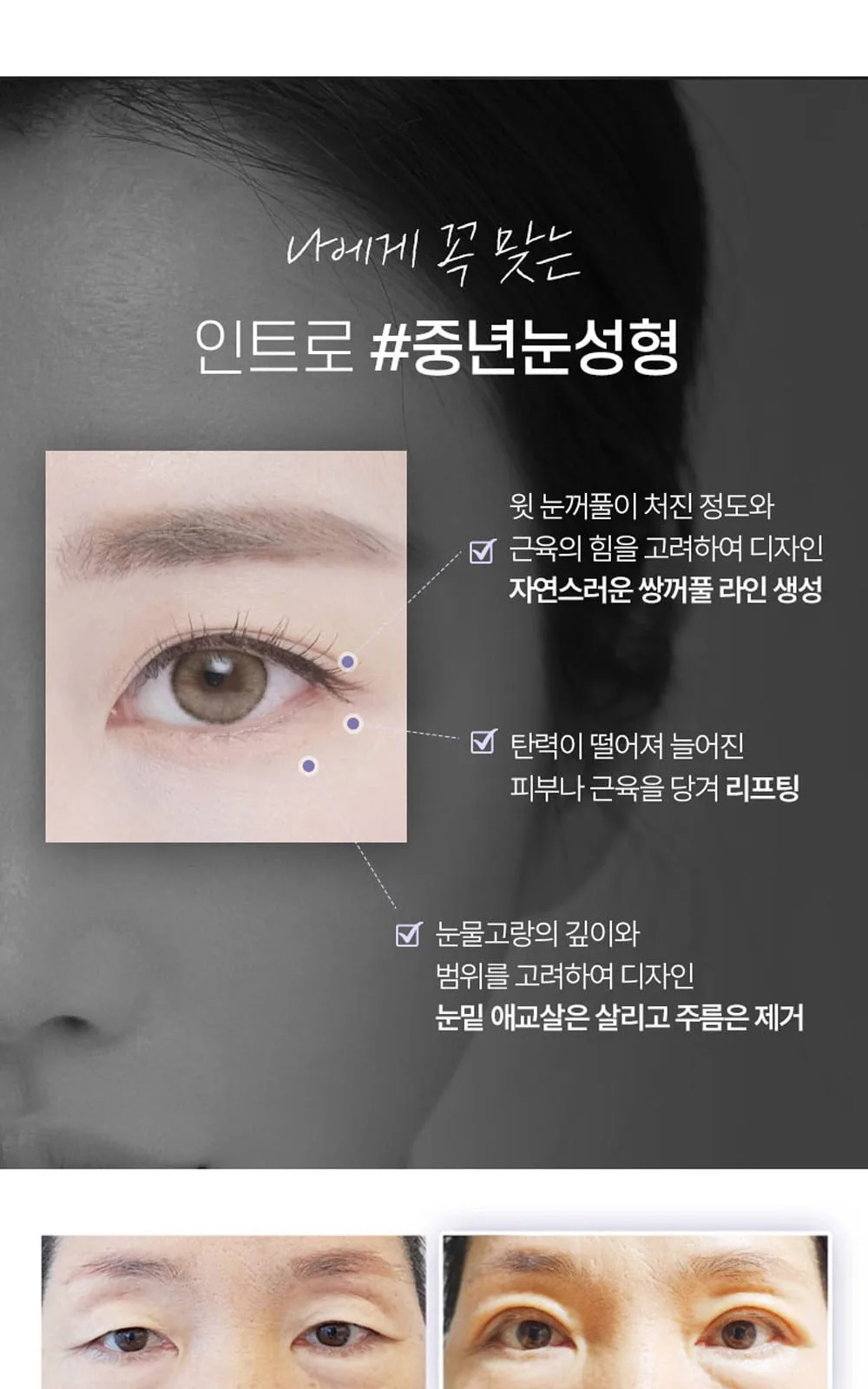 시술 상세 6