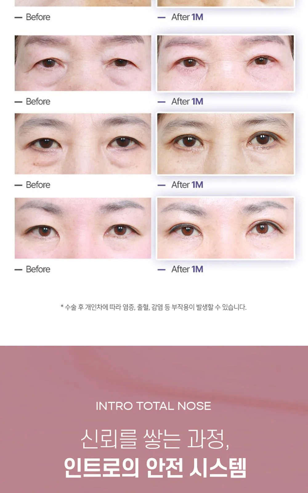 시술 상세 7