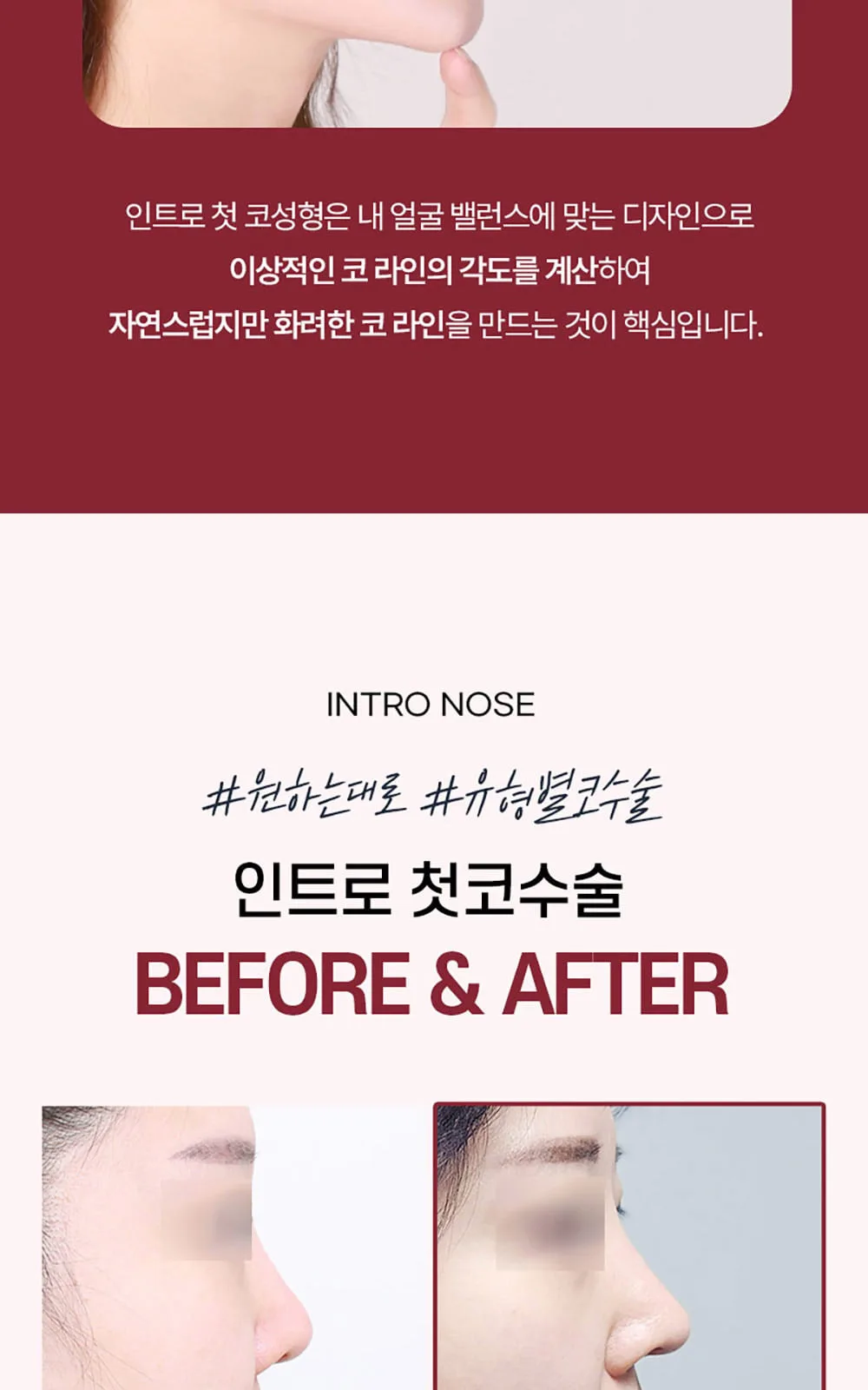 시술 상세 4