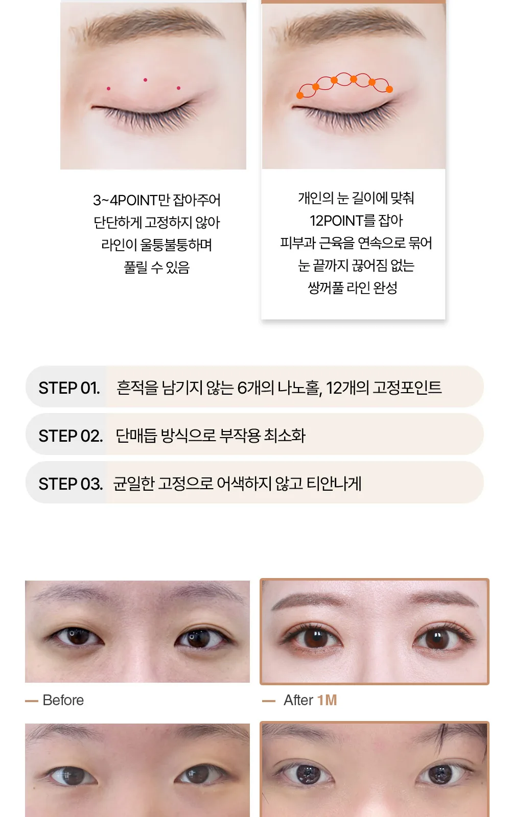 시술 상세 5
