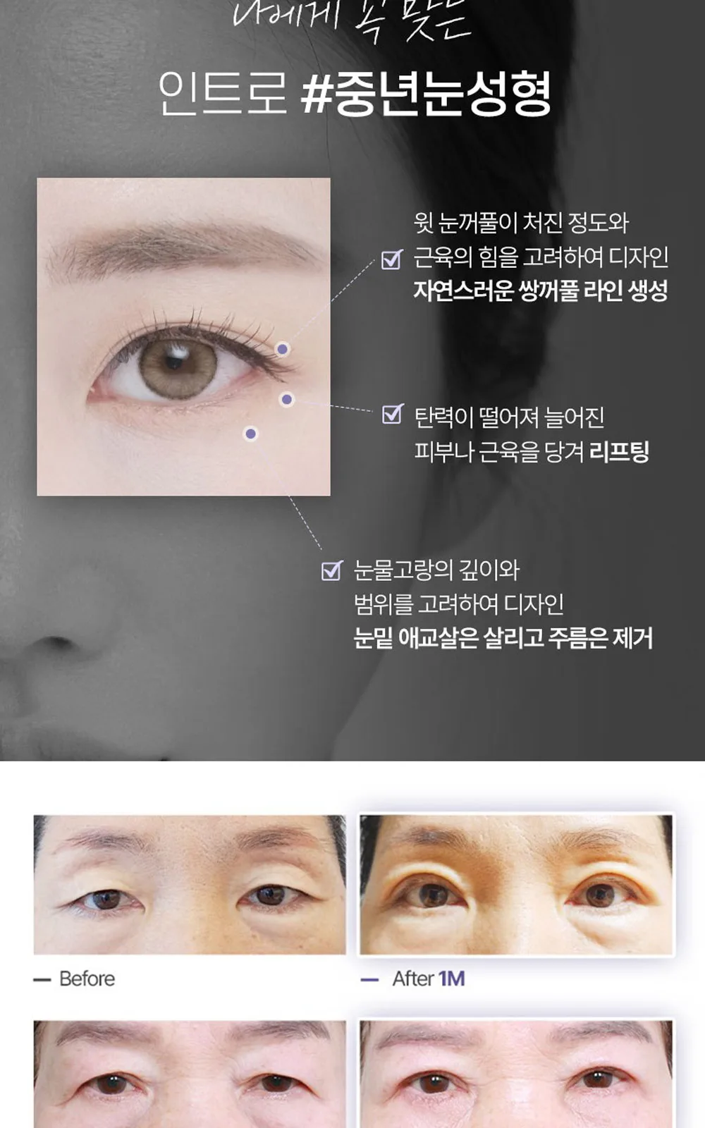 시술 상세 7