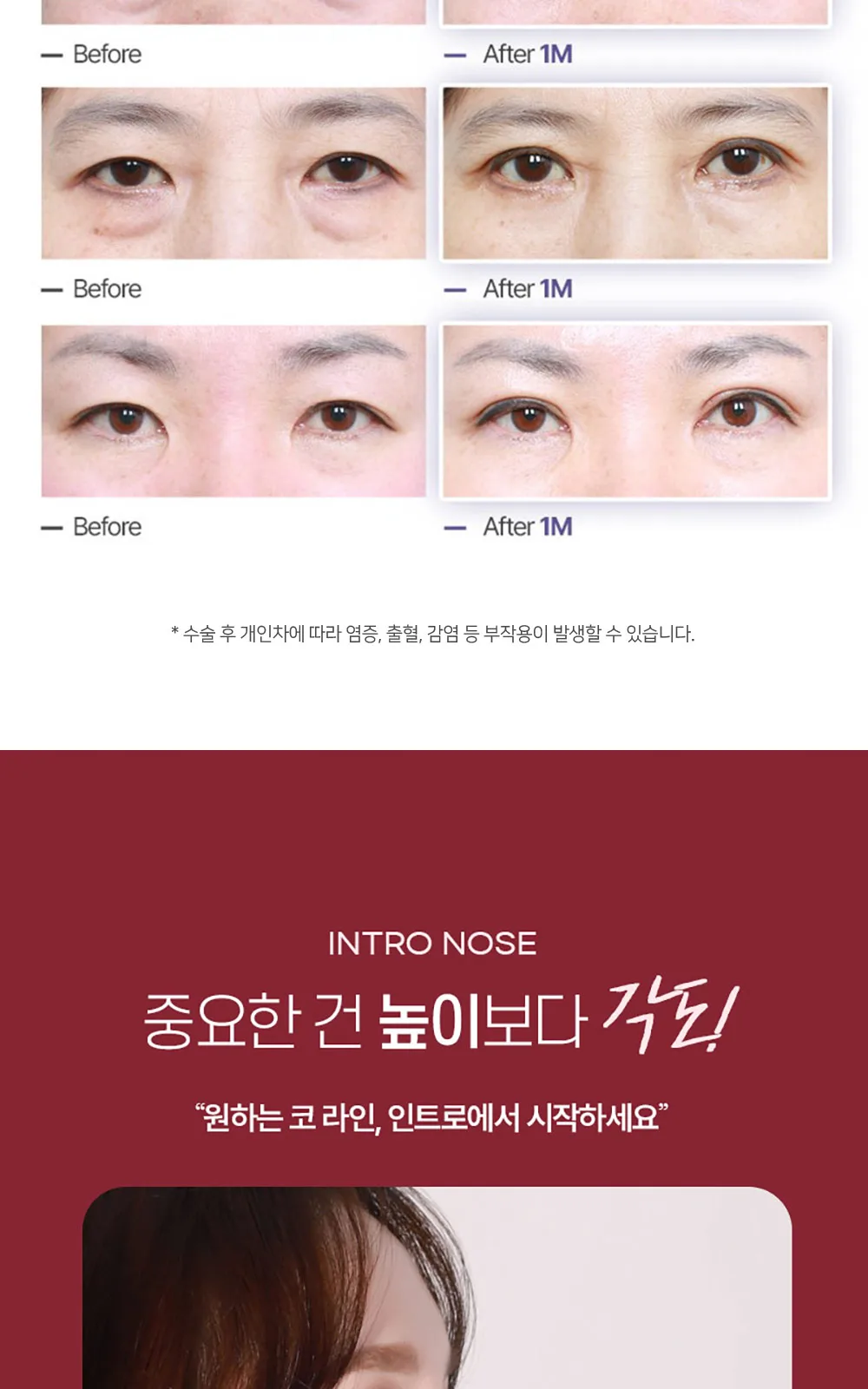 시술 상세 8