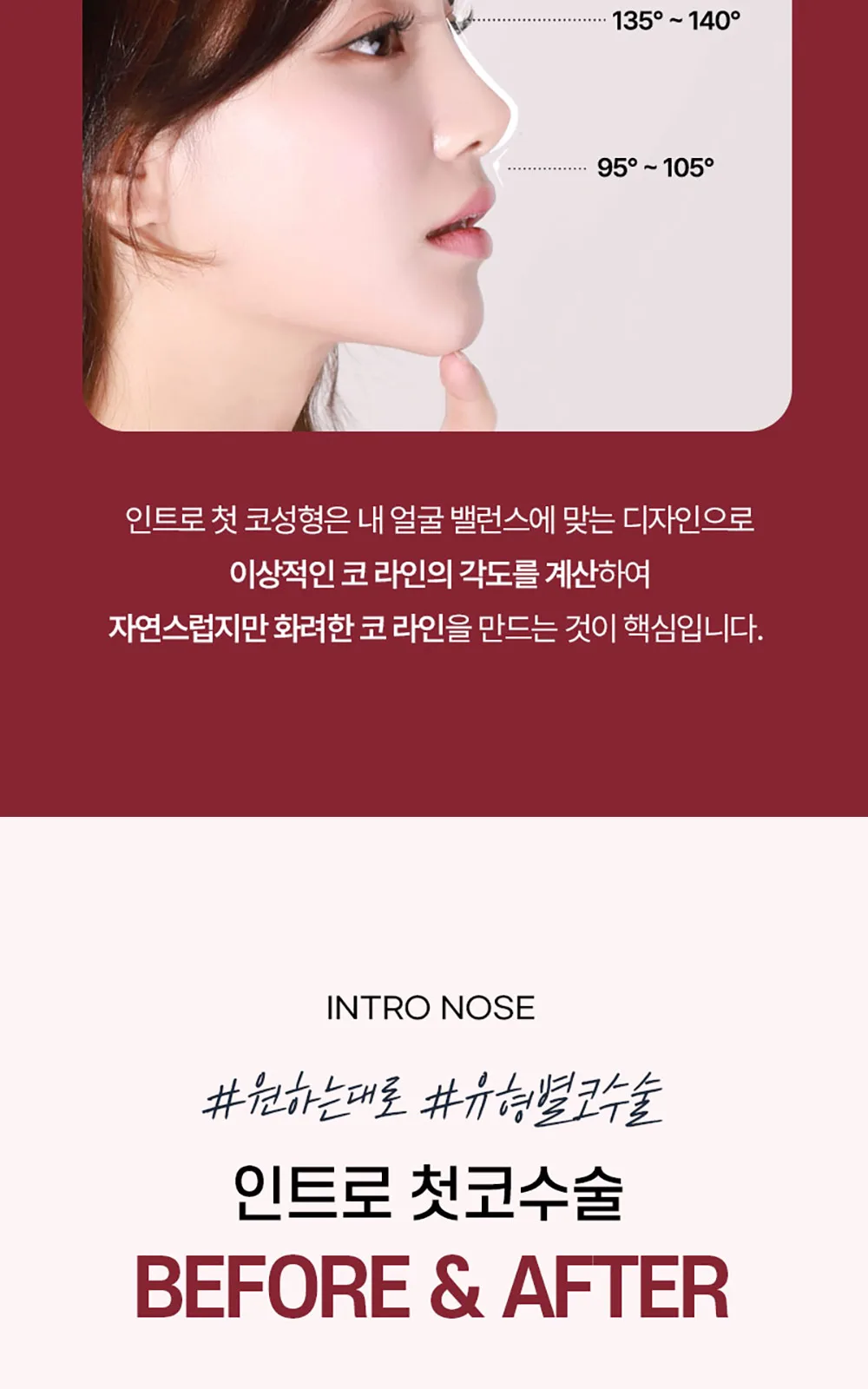 시술 상세 9
