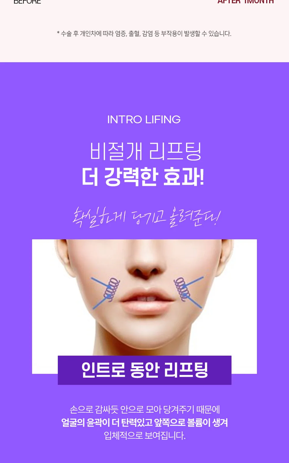 시술 상세 11