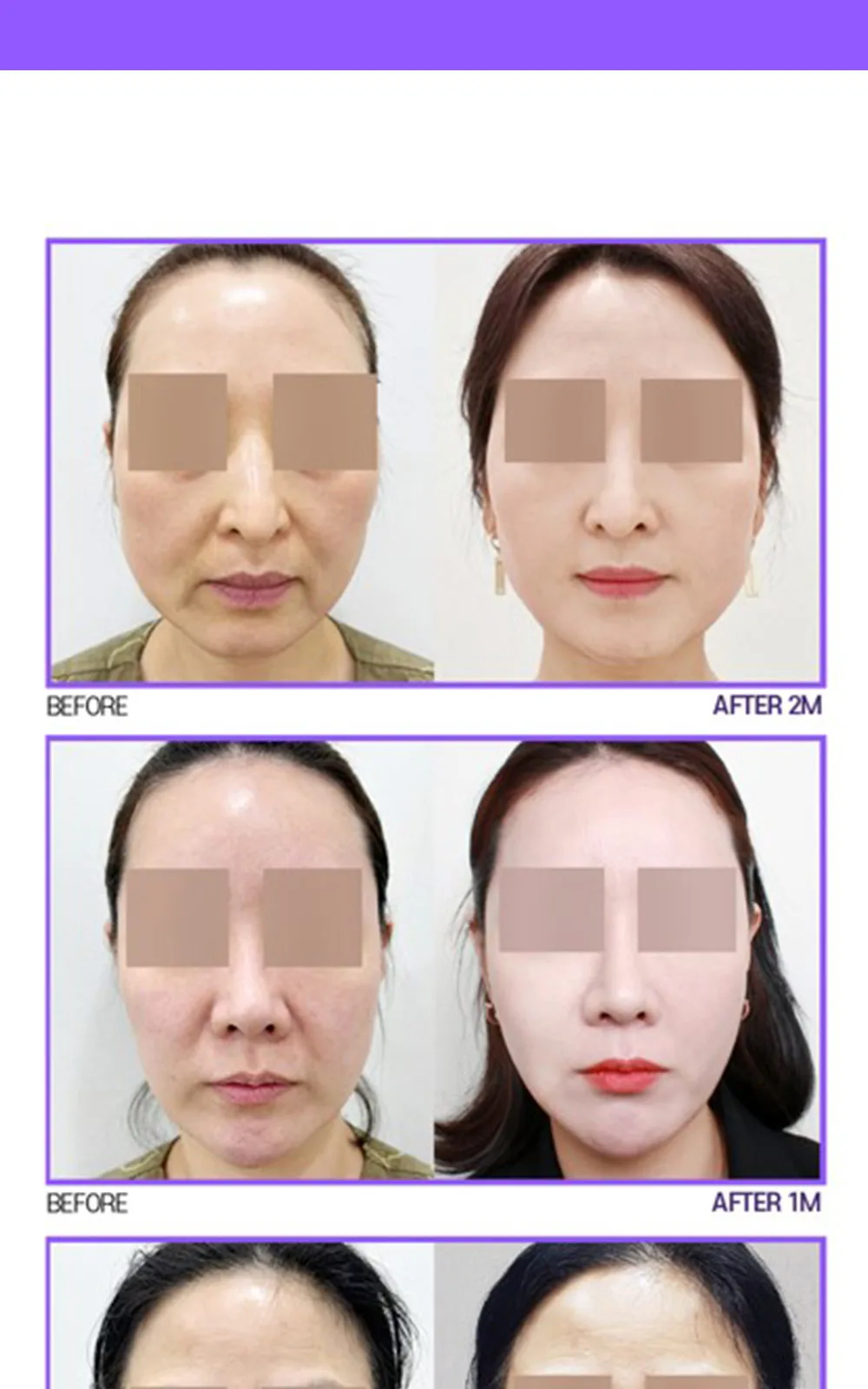 시술 상세 12