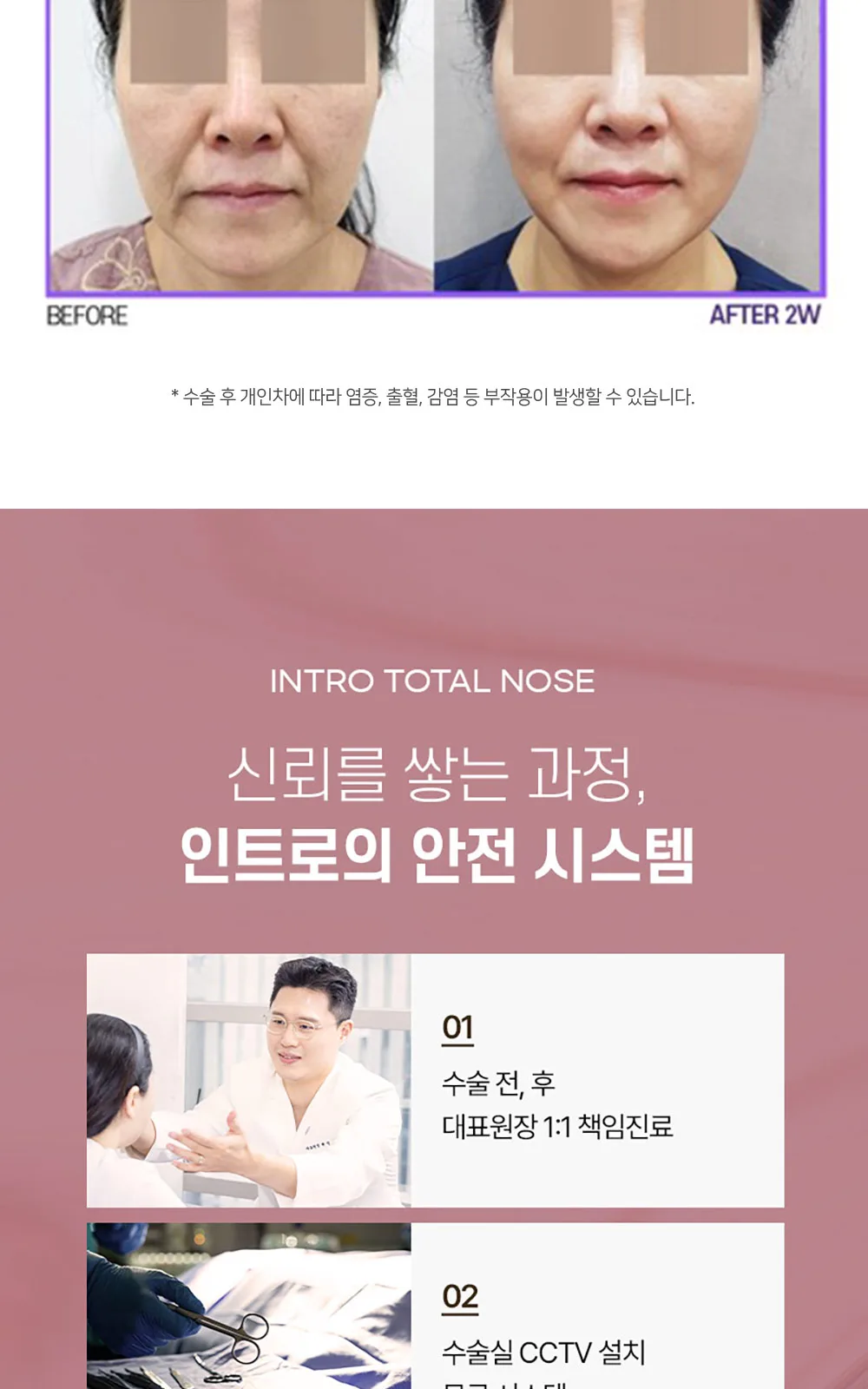 시술 상세 13