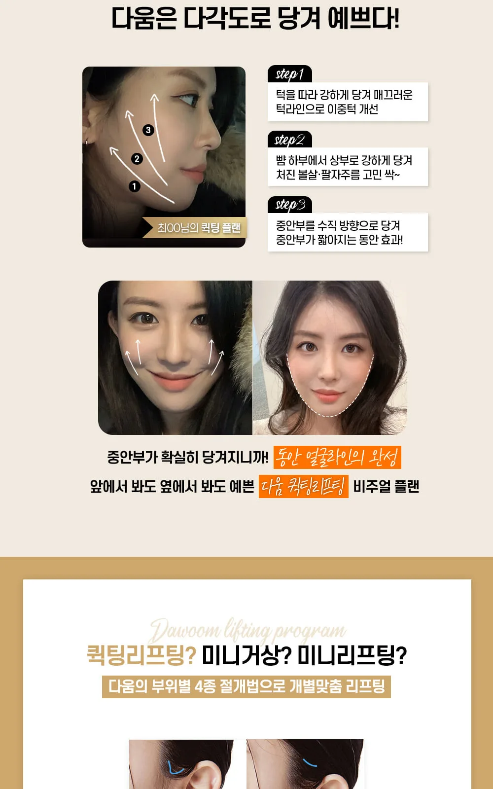 시술 상세 2