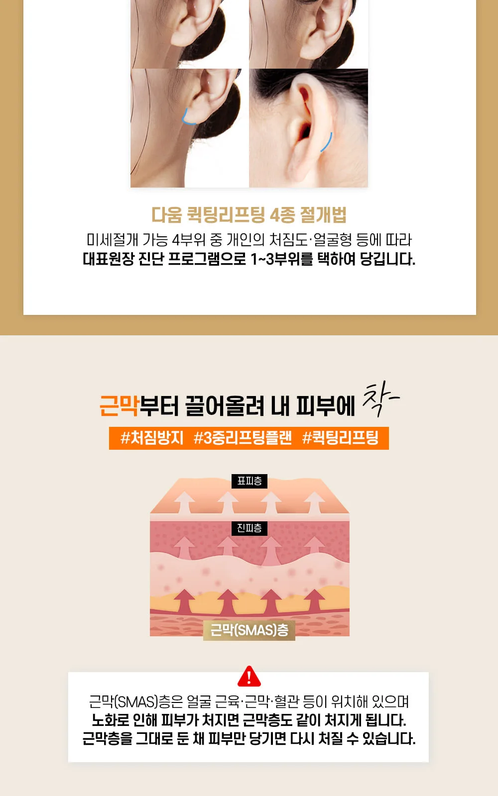 시술 상세 3