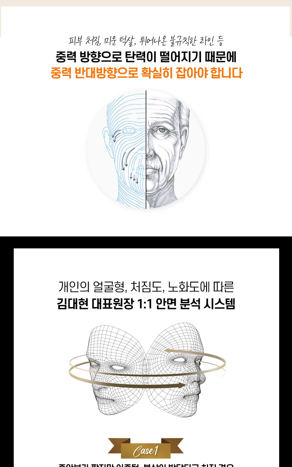 시술 상세 4