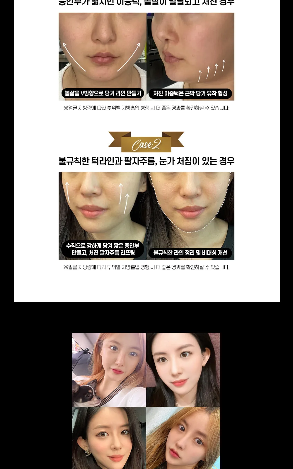 시술 상세 5