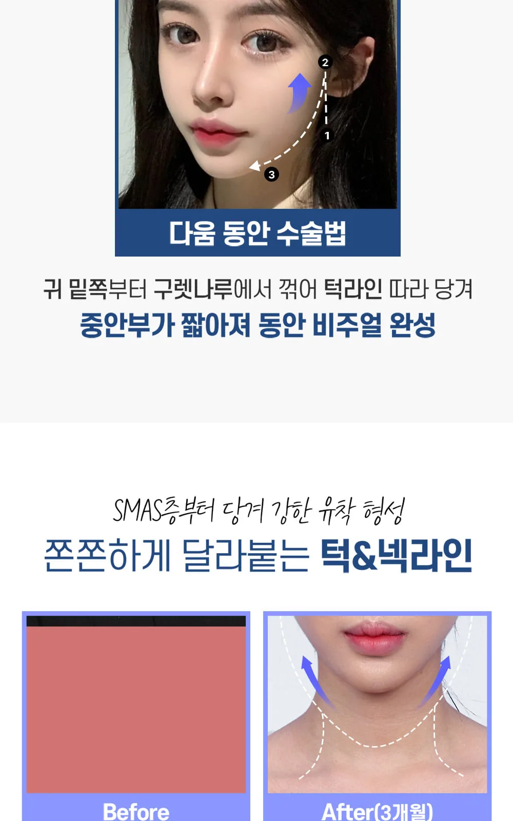 시술 상세 4