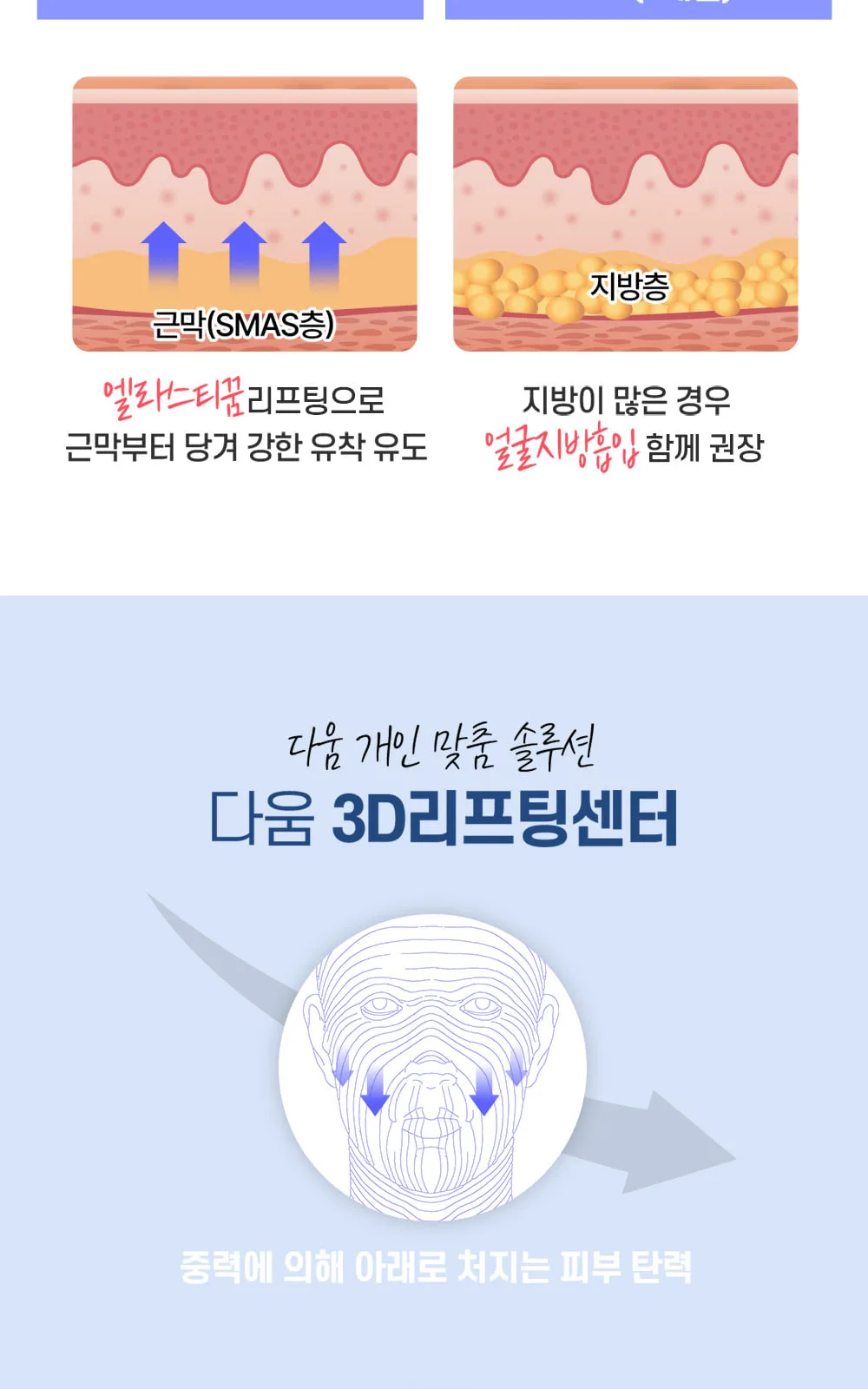 시술 상세 5