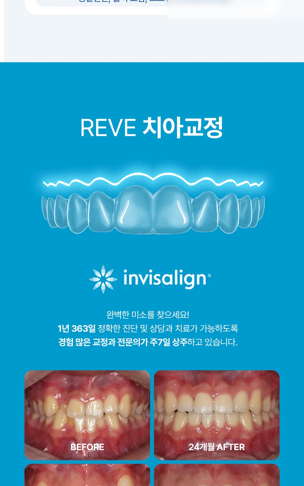 시술 상세 5