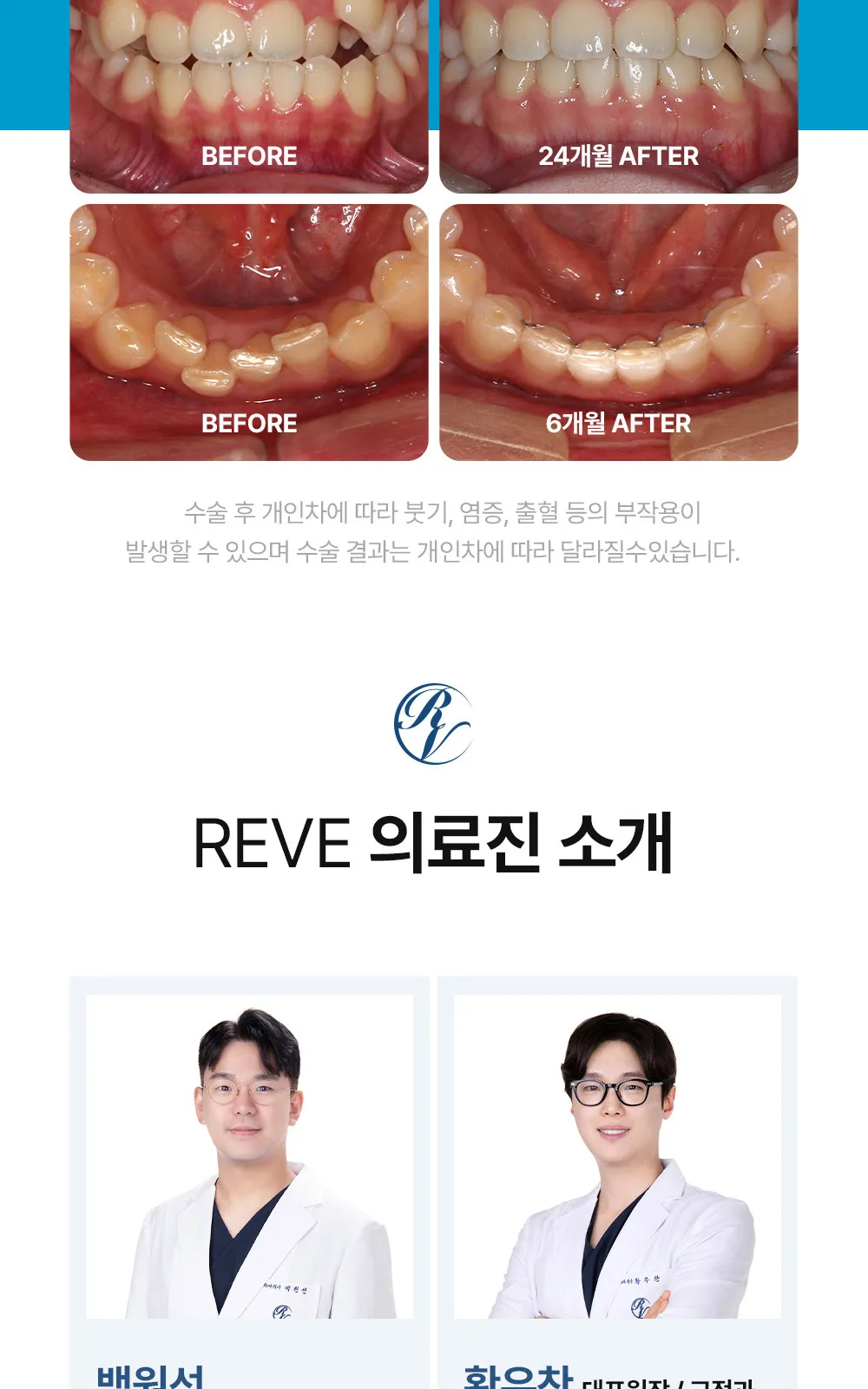 시술 상세 6