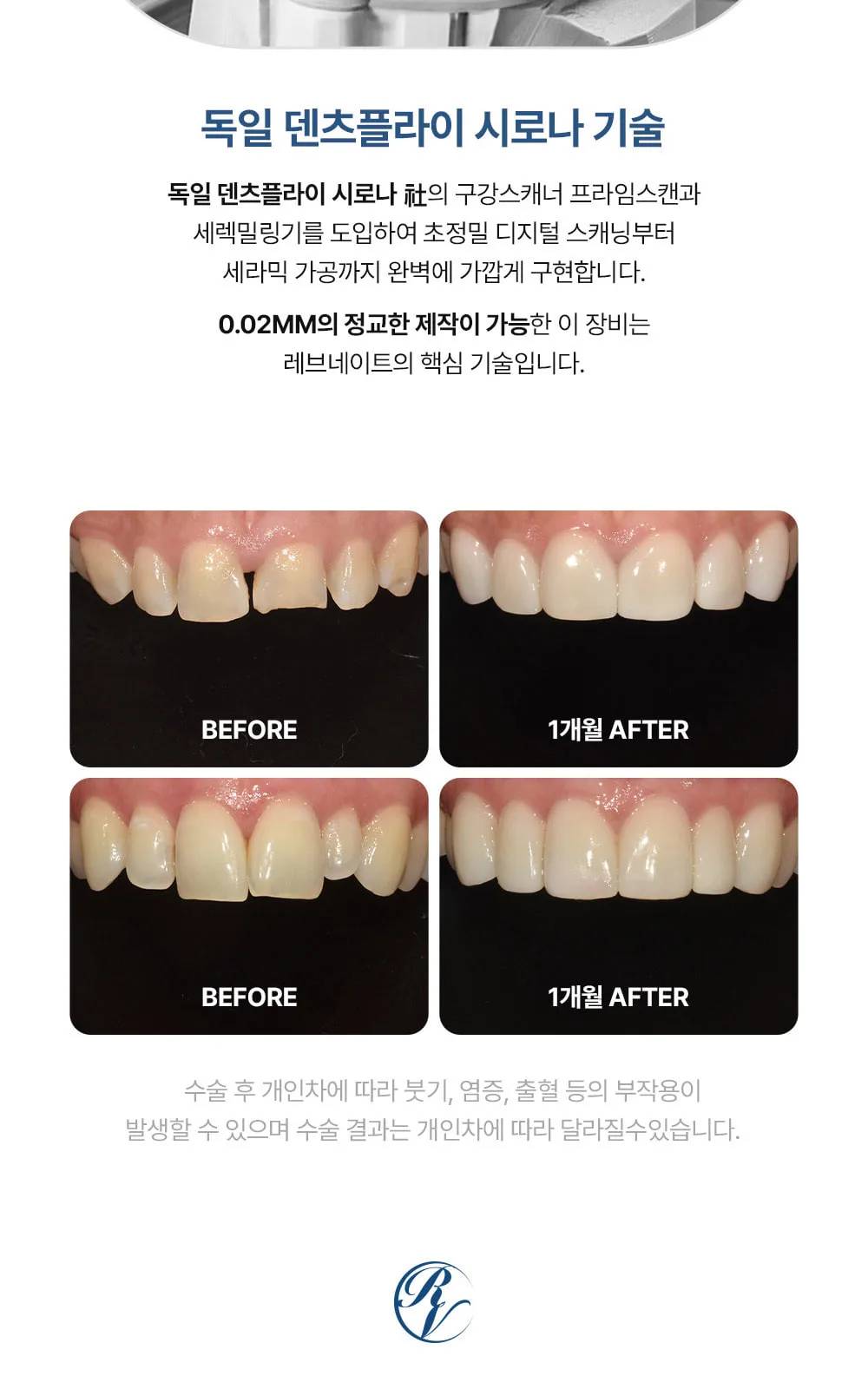 시술 상세 6
