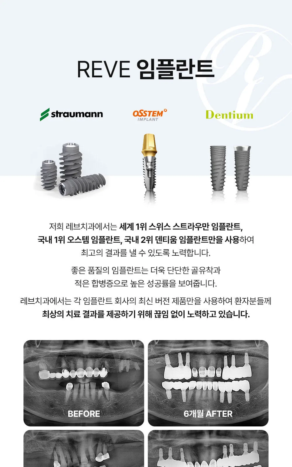 시술 상세 5