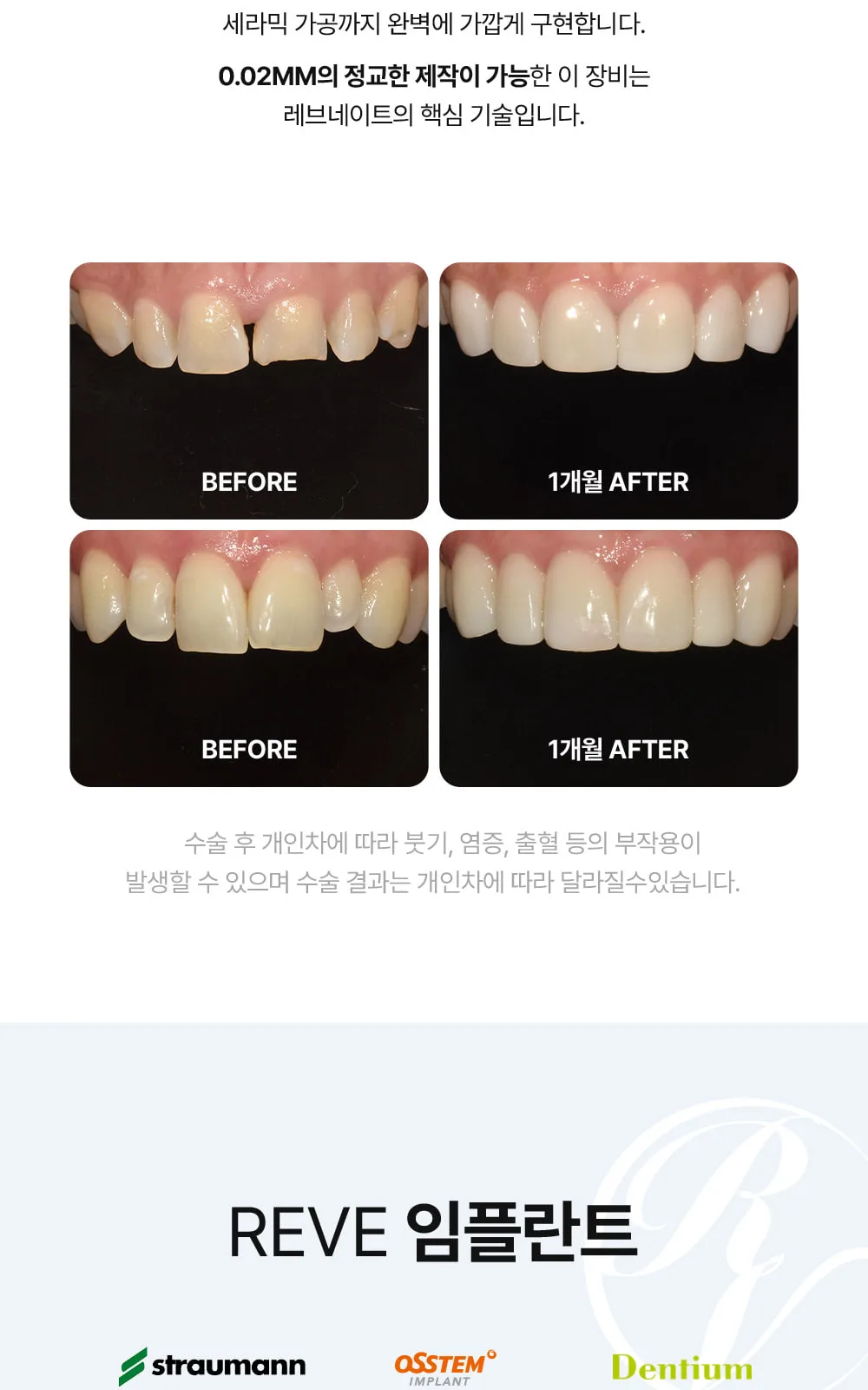 시술 상세 8
