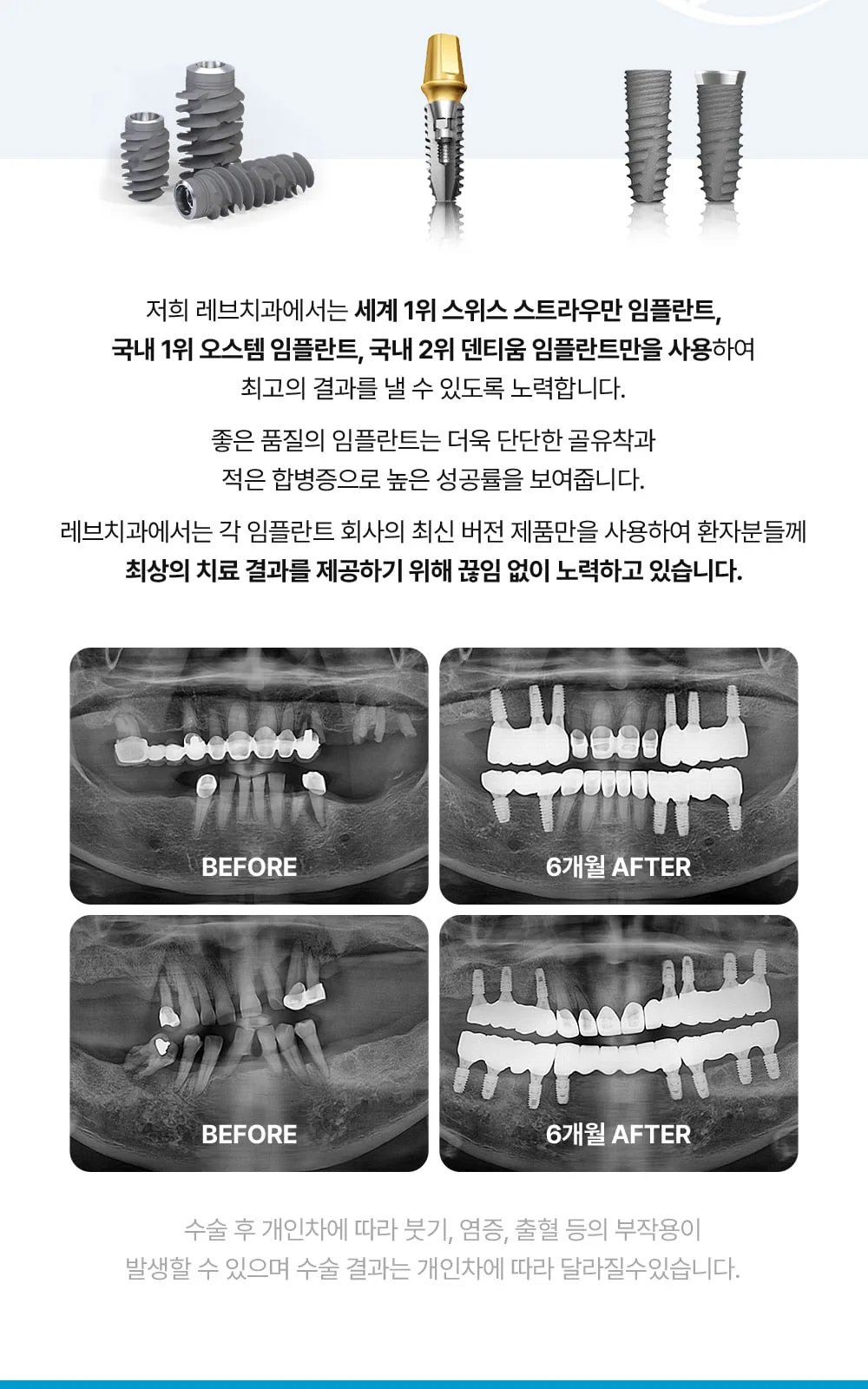 시술 상세 9