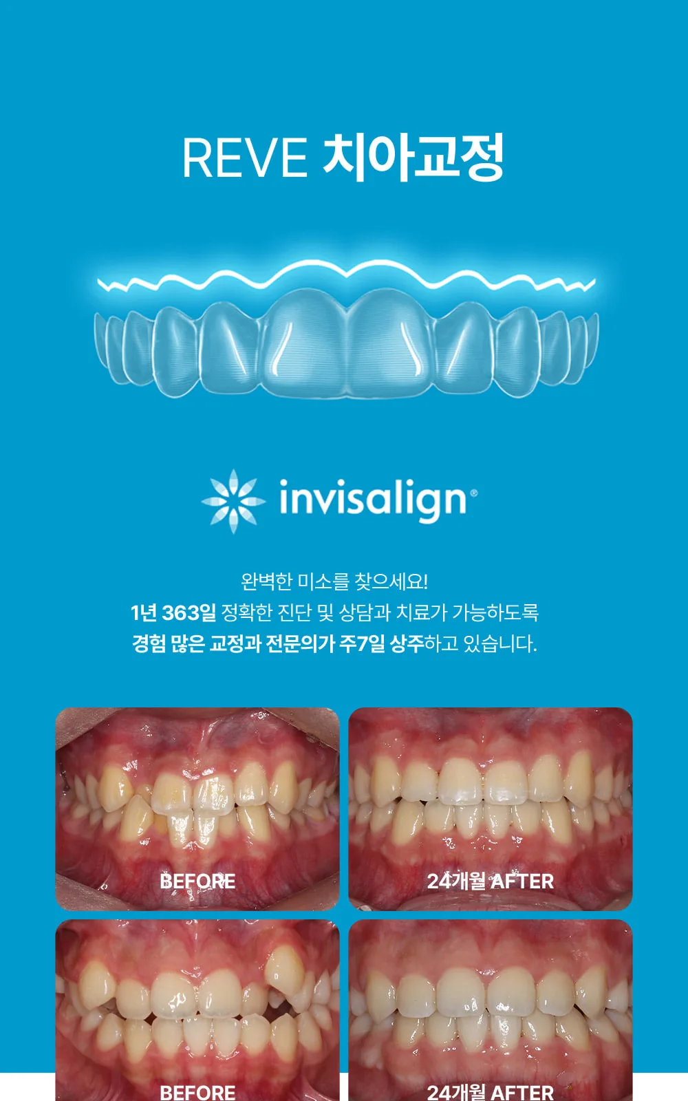 시술 상세 10