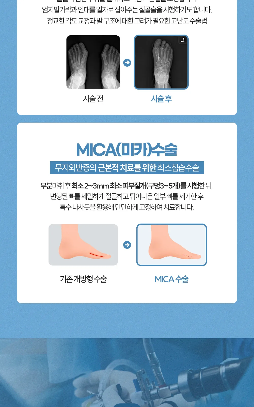 시술 상세 4