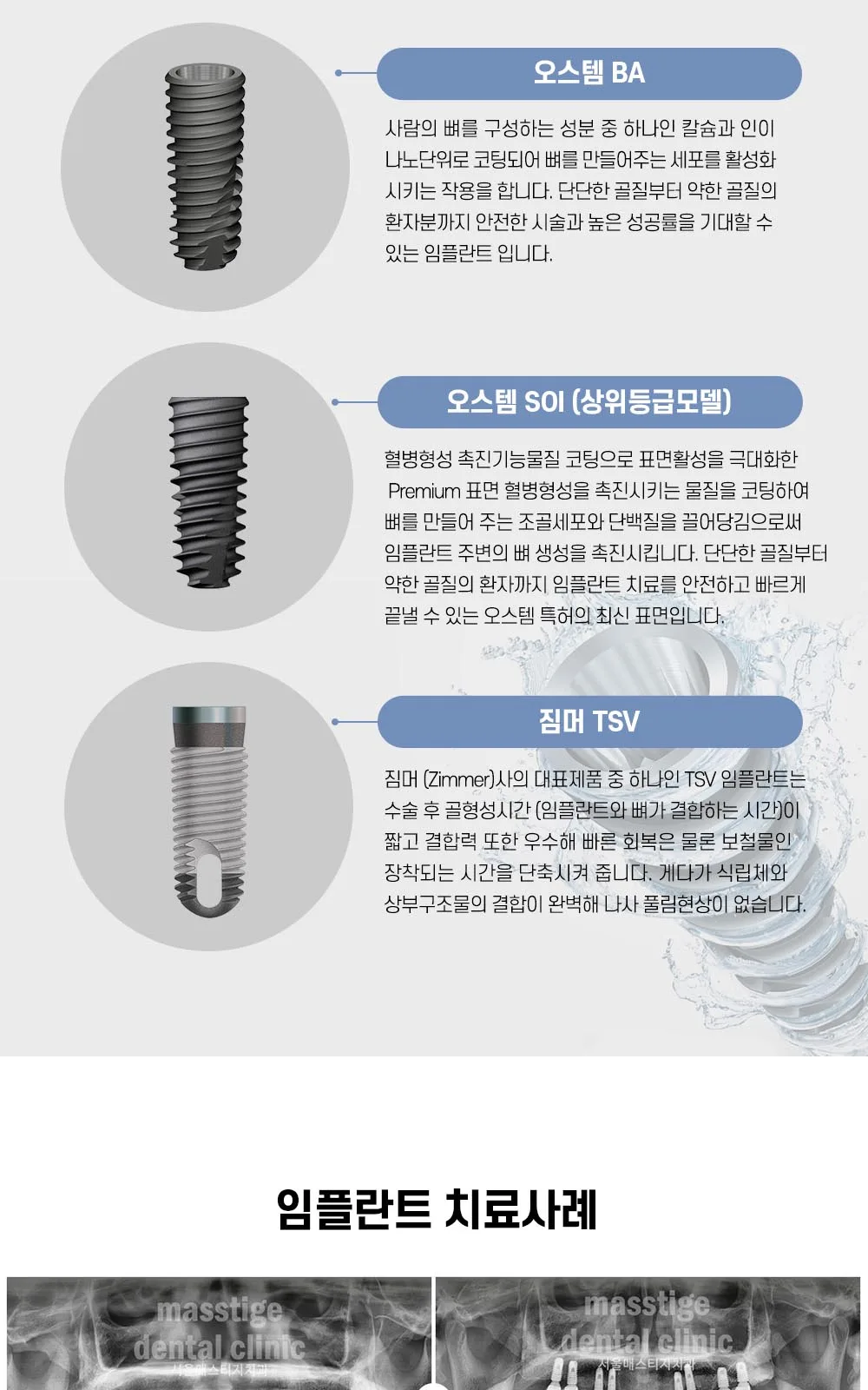 시술 상세 9