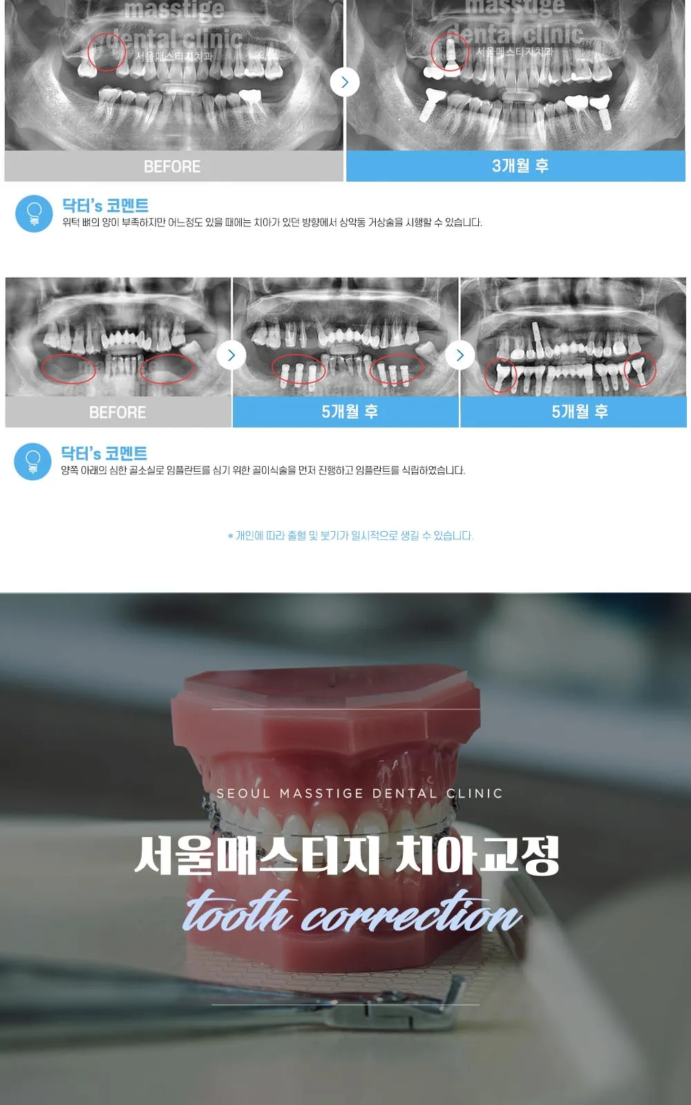 시술 상세 11