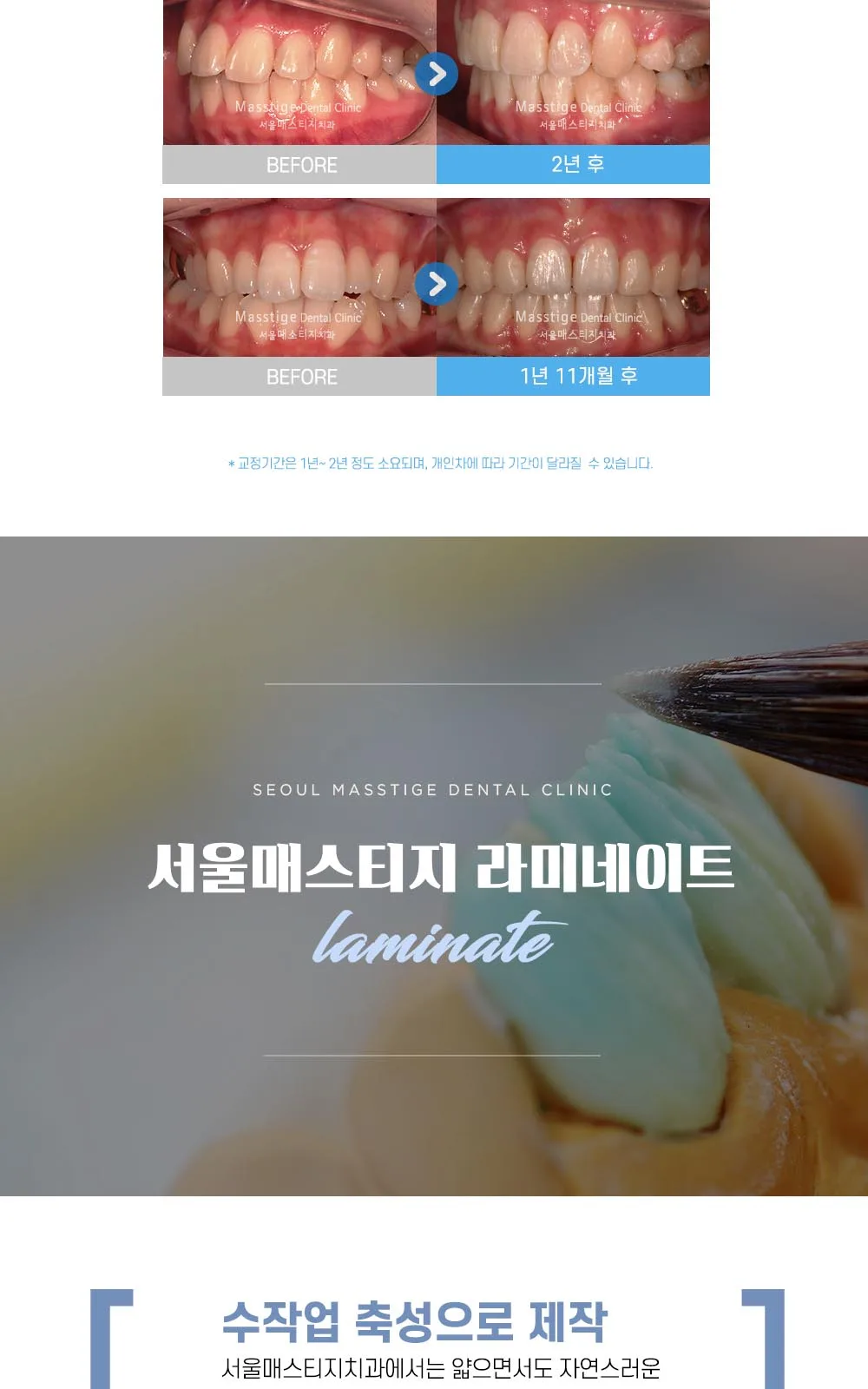 시술 상세 13